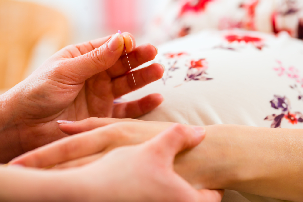 Midwife,Setting,Pregnant,Woman,Acupuncture,Needle