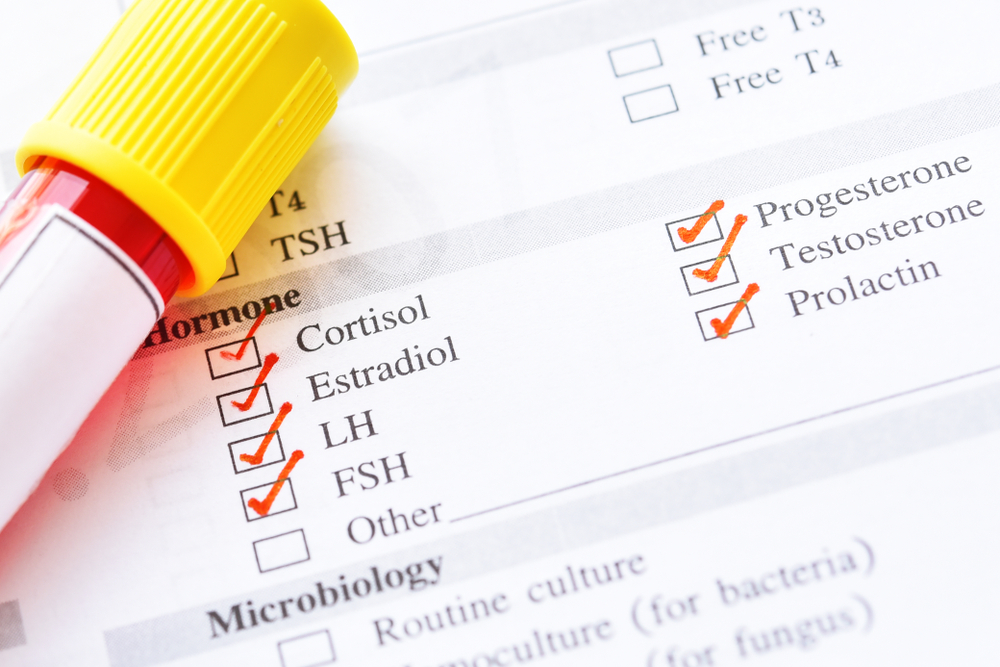 Blood,Sample,Tube,With,Laboratory,Requisition,Form,For,Sex,Hormone