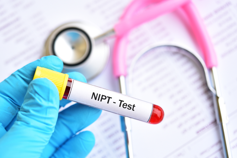 Blood,Sample,For,Nipt,Or,Non,Invasive,Prenatal,Testing,,Diagnosis