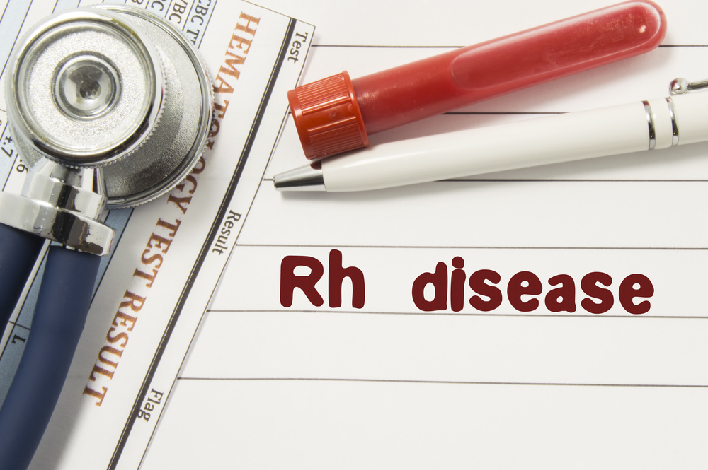 Diagnosis,Of,Rh,Disease.,Test,Tubes,Or,Bottles,For,Blood,