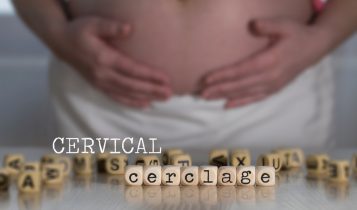 Cerclage